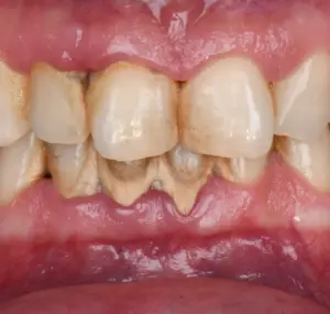 periodontology-BD